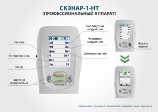 СКЭНАР-1-НТ (исполнение 01)  в Волгодонске купить Медицинский интернет магазин - denaskardio.ru 